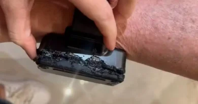 Bolsonaro admite que queimou tornozeleira com ferro quente e é preso preventivamente